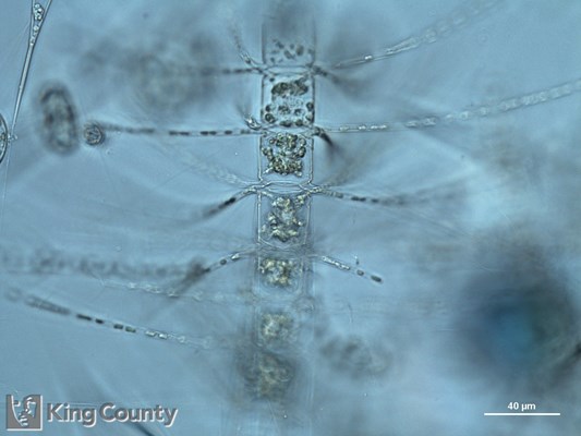 Photo of Chaetoceros eibenii